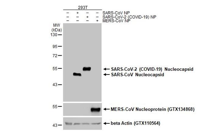 SARS/SARS-CoV-2 Nucleocapsid Antibody in Western Blot (WB)