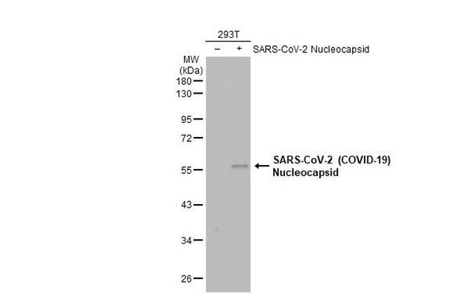 SARS/SARS-CoV-2 Nucleocapsid Antibody in Western Blot (WB)