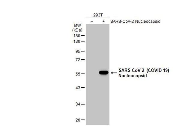 SARS/SARS-CoV-2 Nucleocapsid Antibody in Western Blot (WB)