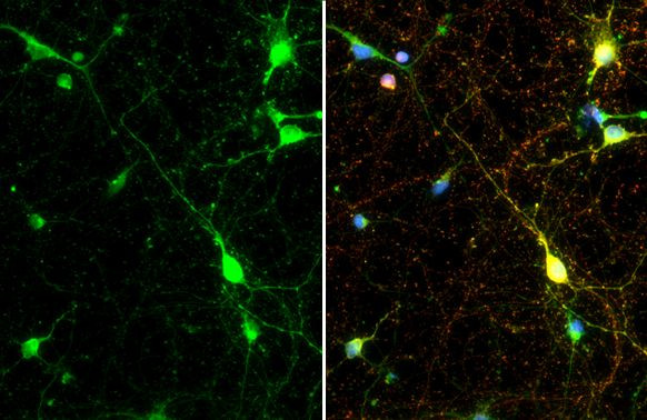 Synapsin II Antibody in Immunocytochemistry (ICC/IF)