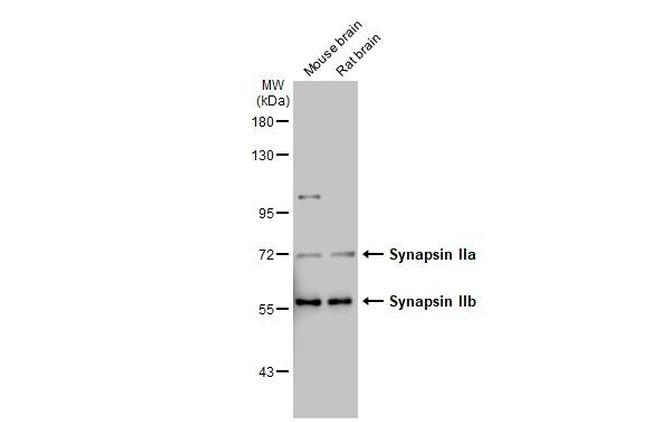 Synapsin II Antibody in Western Blot (WB)