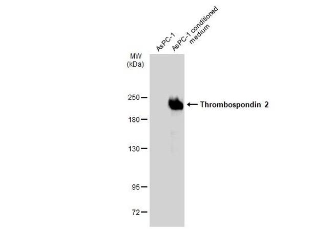 Thrombospondin 2 Antibody in Western Blot (WB)