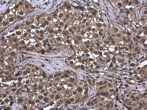 Ubiquitin Antibody in Immunohistochemistry (Paraffin) (IHC (P))