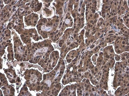 Ubiquitin Antibody in Immunohistochemistry (Paraffin) (IHC (P))