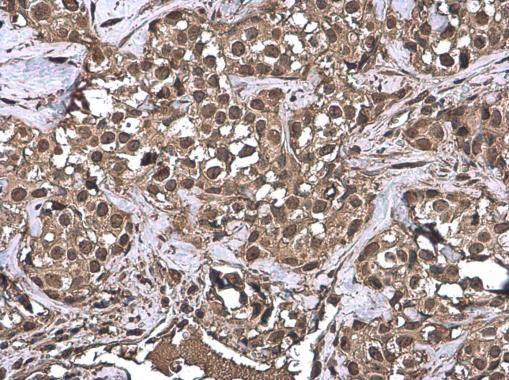 Ubiquitin Antibody in Immunohistochemistry (Paraffin) (IHC (P))