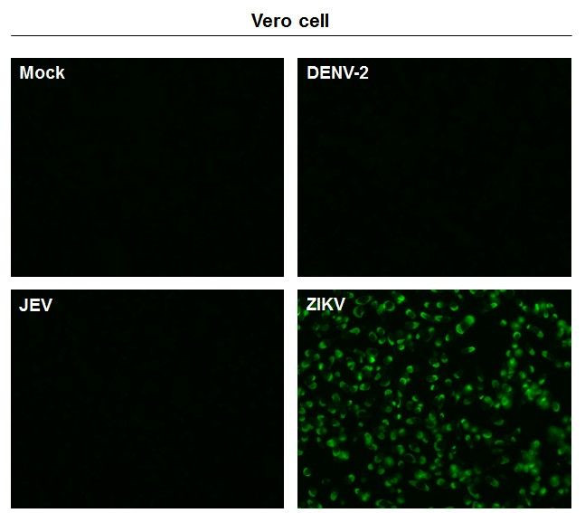 Zika Virus NS1 Antibody in Immunocytochemistry (ICC/IF)