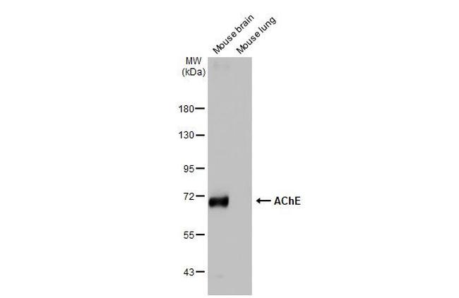 Acetylcholinesterase Antibody in Western Blot (WB)