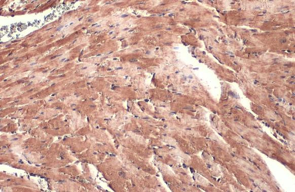 DDR2 Antibody in Immunohistochemistry (Paraffin) (IHC (P))