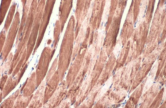 DDR2 Antibody in Immunohistochemistry (Paraffin) (IHC (P))