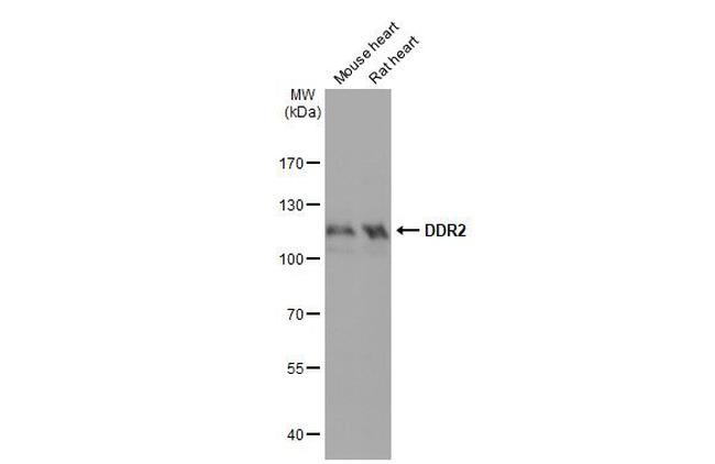 DDR2 Antibody in Western Blot (WB)