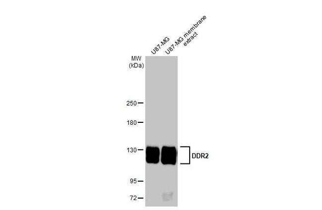 DDR2 Antibody in Western Blot (WB)