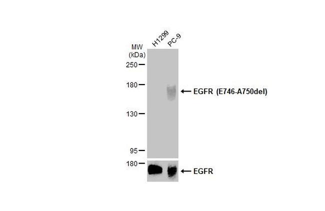 EGFR (E746-A750del) Antibody in Western Blot (WB)