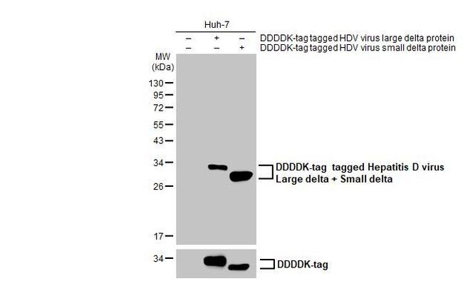 Hepatitis D virus Antibody in Western Blot (WB)