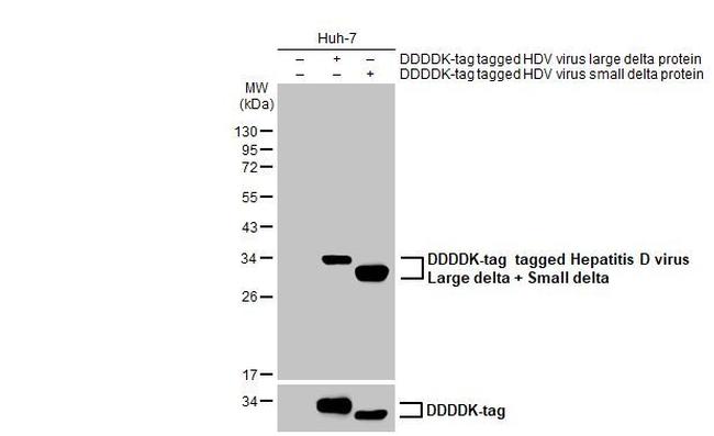 Hepatitis D virus Antibody in Western Blot (WB)