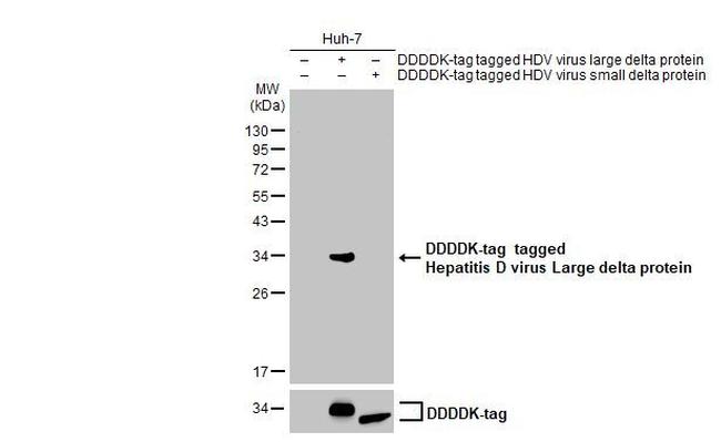 Hepatitis D Virus Large delta Protein Antibody in Western Blot (WB)