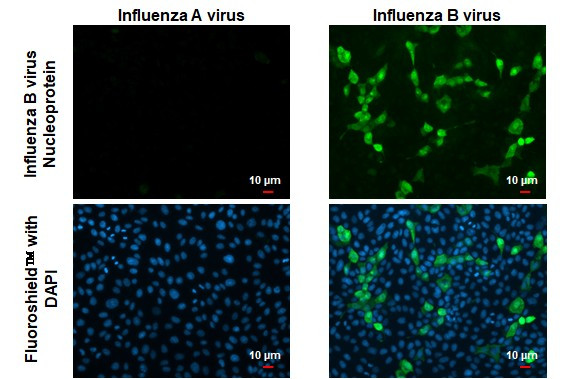 Influenza B NP Antibody in Immunocytochemistry (ICC/IF)