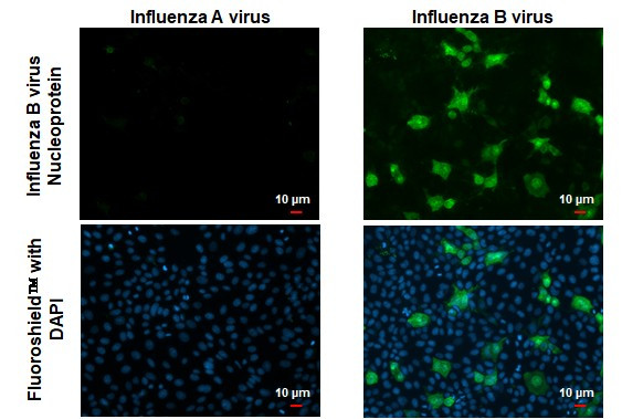 Influenza B NP Antibody in Immunocytochemistry (ICC/IF)