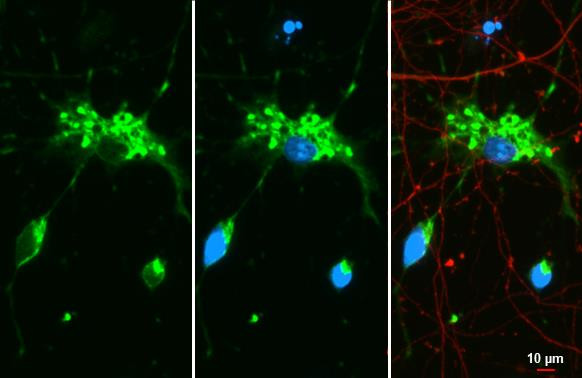 MBP Antibody in Immunocytochemistry (ICC/IF)