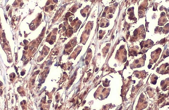 Nrf2 Antibody in Immunohistochemistry (Paraffin) (IHC (P))