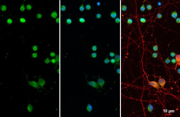 OLIG2 Antibody in Immunocytochemistry (ICC/IF)