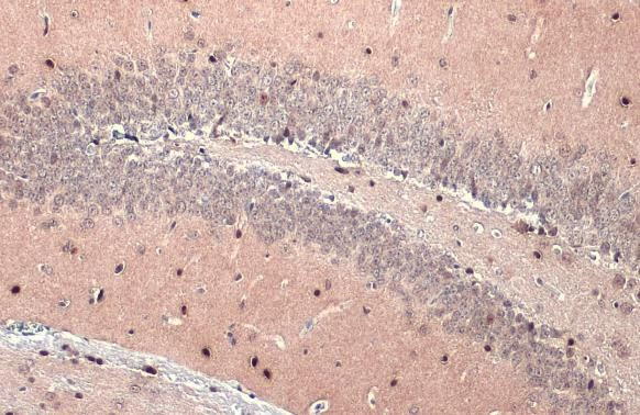 OLIG2 Antibody in Immunohistochemistry (Paraffin) (IHC (P))