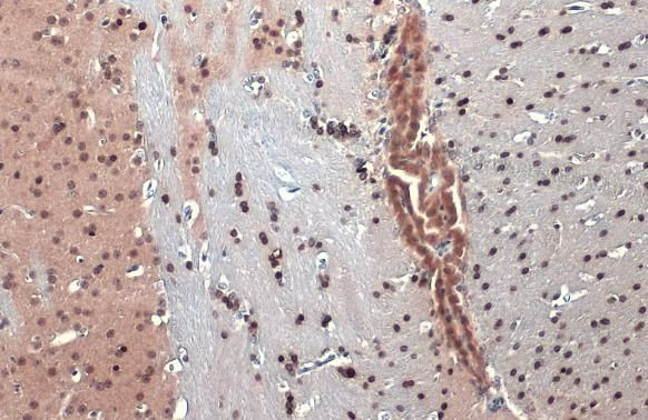 OLIG2 Antibody in Immunohistochemistry (Paraffin) (IHC (P))