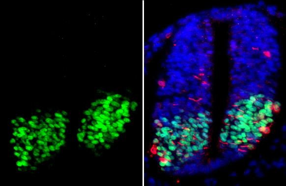 OLIG2 Antibody in Immunohistochemistry (Paraffin) (IHC (P))