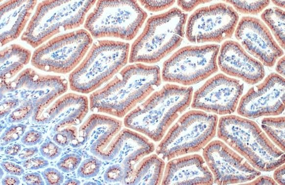 RAB6A Antibody in Immunohistochemistry (Paraffin) (IHC (P))