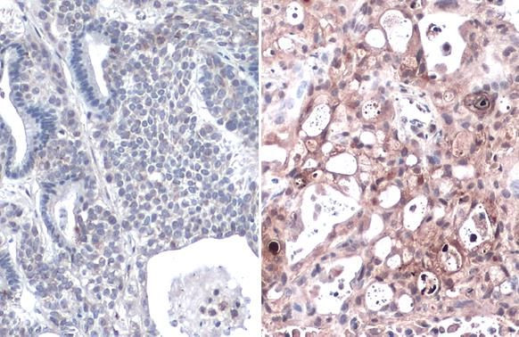 K-Ras (G12V Mutant) Antibody in Immunohistochemistry (Paraffin) (IHC (P))