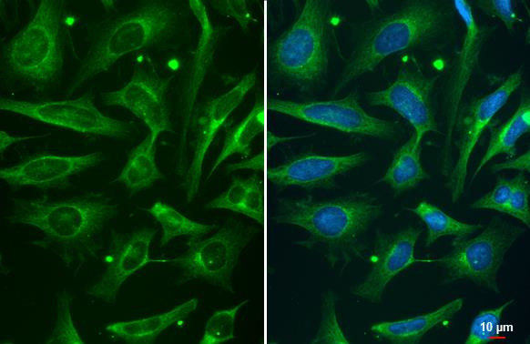 Phospho-ROCK2 (Ser1366) Antibody in Immunocytochemistry (ICC/IF)