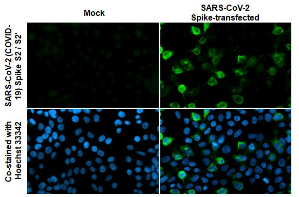 SARS-CoV-2 Spike Protein S2 Antibody in Immunocytochemistry (ICC/IF)