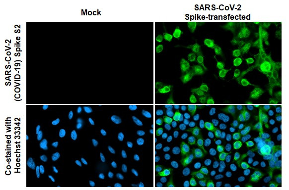 SARS/SARS-CoV-2 Spike Protein S2 Antibody in Immunocytochemistry (ICC/IF)