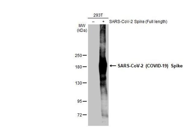 SARS/SARS-CoV-2 Spike Protein S2 Antibody in Western Blot (WB)