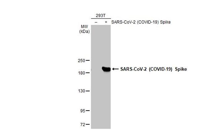 SARS/SARS-CoV-2 Spike Protein S2 Antibody in Western Blot (WB)