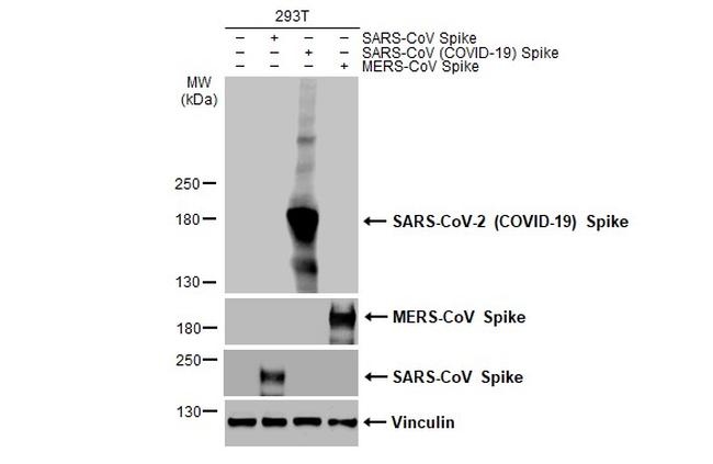 SARS/SARS-CoV-2 Spike Protein S2 Antibody in Western Blot (WB)