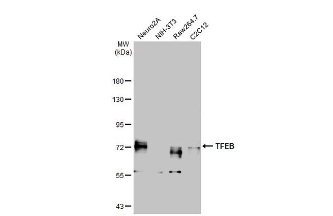 TFEB Antibody in Western Blot (WB)