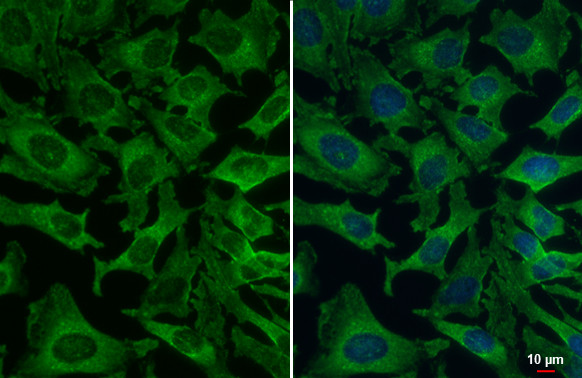 VPS35 Antibody in Immunocytochemistry (ICC/IF)