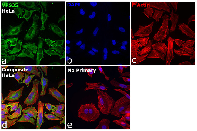 VPS35 Antibody in Immunocytochemistry (ICC/IF)