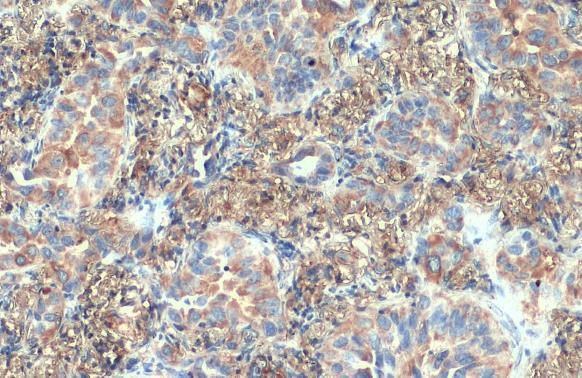 VPS35 Antibody in Immunohistochemistry (Paraffin) (IHC (P))