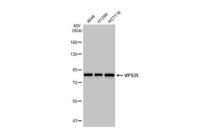 VPS35 Antibody in Western Blot (WB)