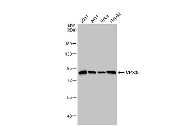 VPS35 Antibody in Western Blot (WB)