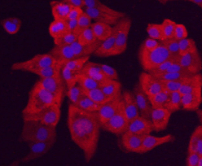 Chromogranin A Antibody in Immunocytochemistry (ICC/IF)