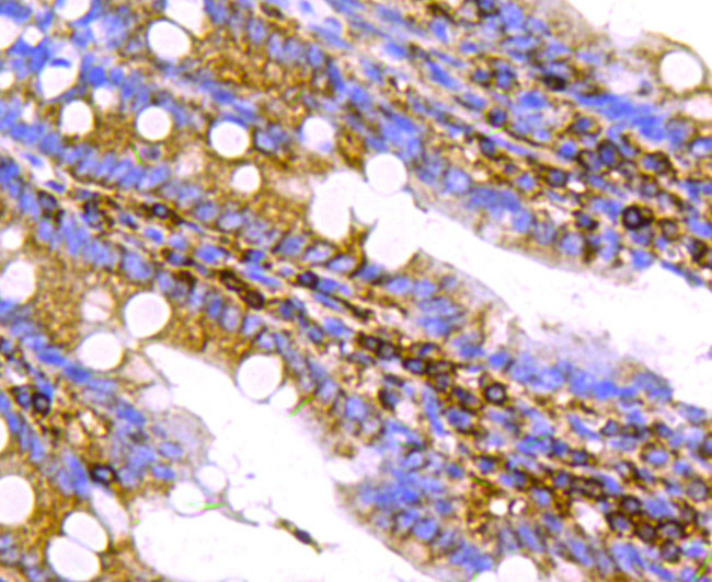 Chromogranin A Antibody in Immunohistochemistry (Paraffin) (IHC (P))