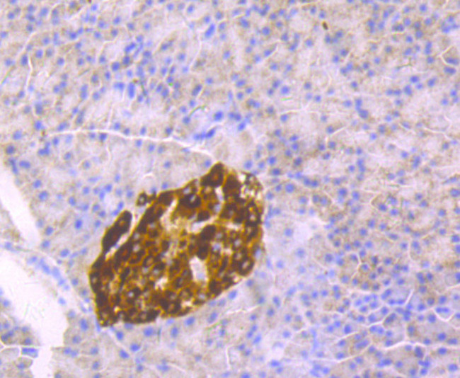 Chromogranin A Antibody in Immunohistochemistry (Paraffin) (IHC (P))