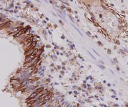 Cytokeratin 7 Antibody in Immunohistochemistry (Paraffin) (IHC (P))