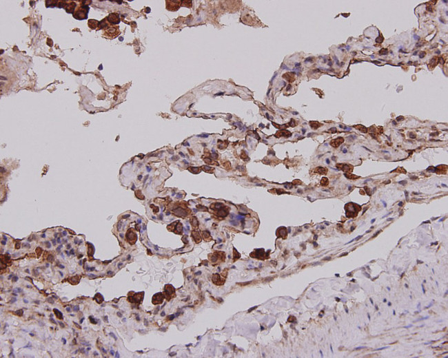 Cytokeratin 7 Antibody in Immunohistochemistry (Paraffin) (IHC (P))