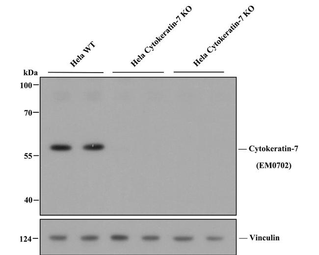 Cytokeratin 7 Antibody in Western Blot (WB)