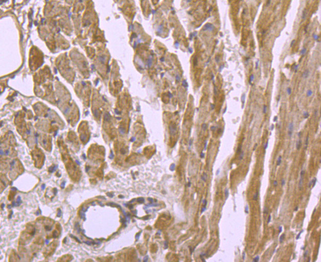 Cardiac Troponin T Antibody in Immunohistochemistry (Paraffin) (IHC (P))