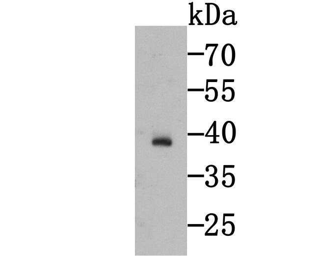 Cardiac Troponin T Antibody in Western Blot (WB)