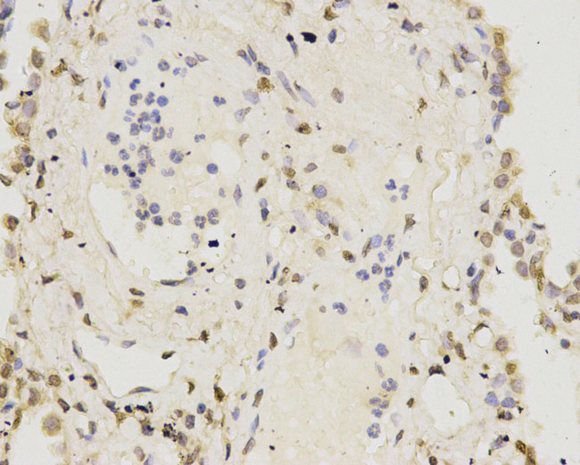 IFNAR1 Antibody in Immunohistochemistry (Paraffin) (IHC (P))